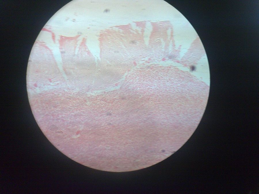 Archive: photograph of a human cerebellum specimen — 1 July 2009 (Abdulrazakca, public domain). Not the 18 September 2026 Aqneursa FDA approval, not an IntraBio trial participant, not IB1001-303 site photography, and not A-T Children’s Project imagery.